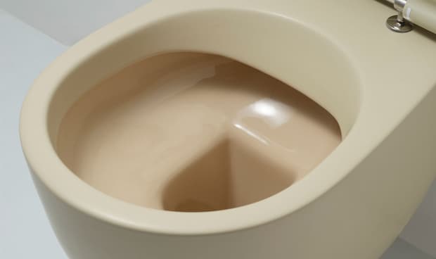 Il wc pu&ograve; nascondere un'ostruzione