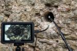 Endoscopia su muro a sacco